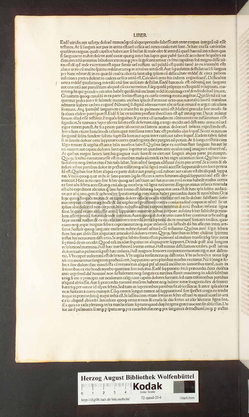 http://diglib.hab.de/inkunabeln/72-quod-2f-4/00016.jpg