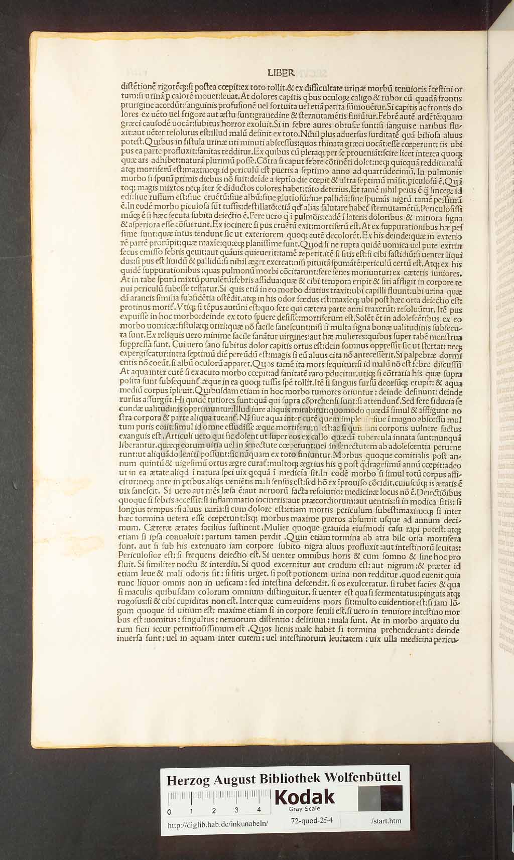 http://diglib.hab.de/inkunabeln/72-quod-2f-4/00018.jpg