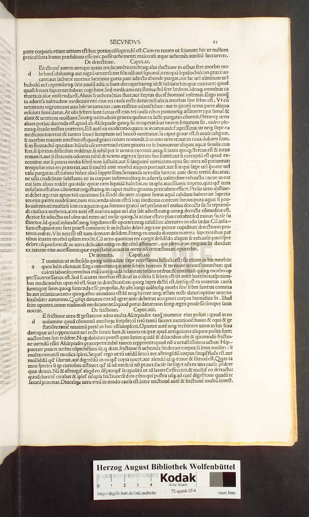 http://diglib.hab.de/inkunabeln/72-quod-2f-4/00021.jpg