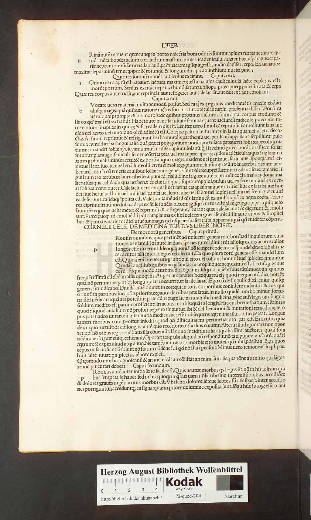 http://diglib.hab.de/inkunabeln/72-quod-2f-4/00026.jpg