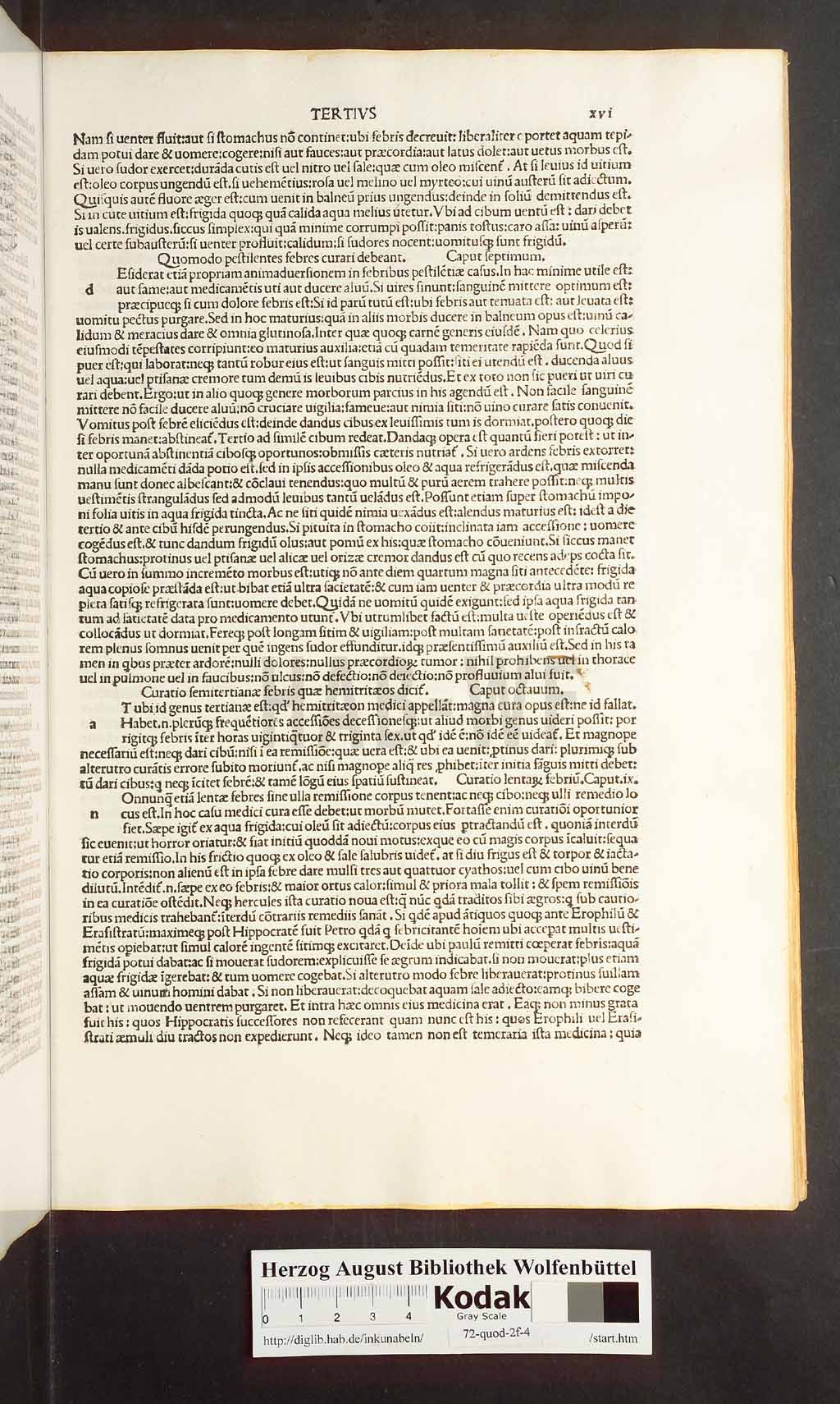 http://diglib.hab.de/inkunabeln/72-quod-2f-4/00031.jpg