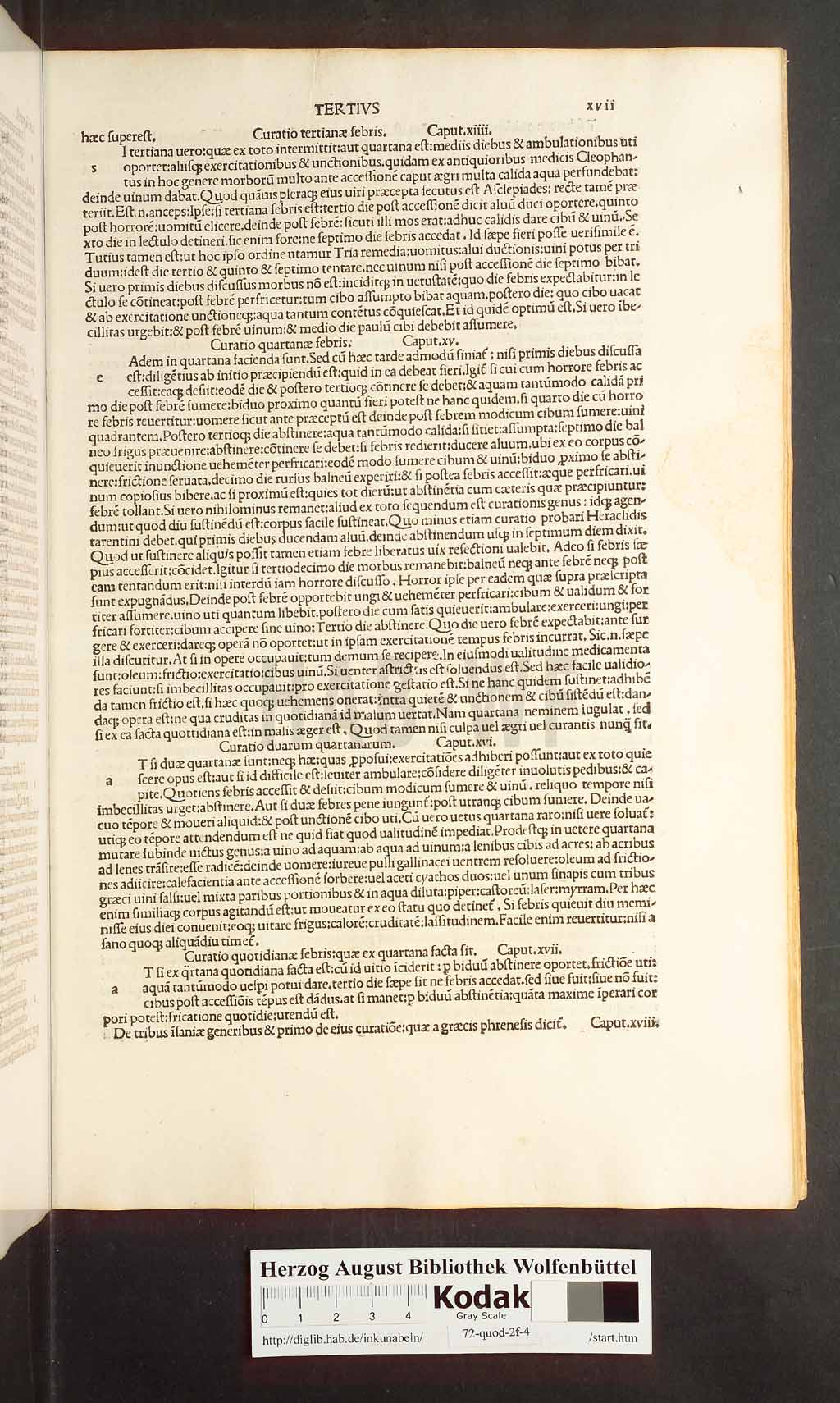 http://diglib.hab.de/inkunabeln/72-quod-2f-4/00033.jpg