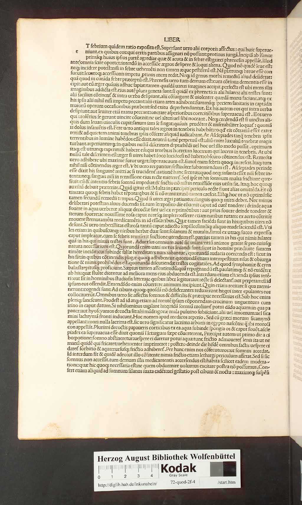 http://diglib.hab.de/inkunabeln/72-quod-2f-4/00034.jpg