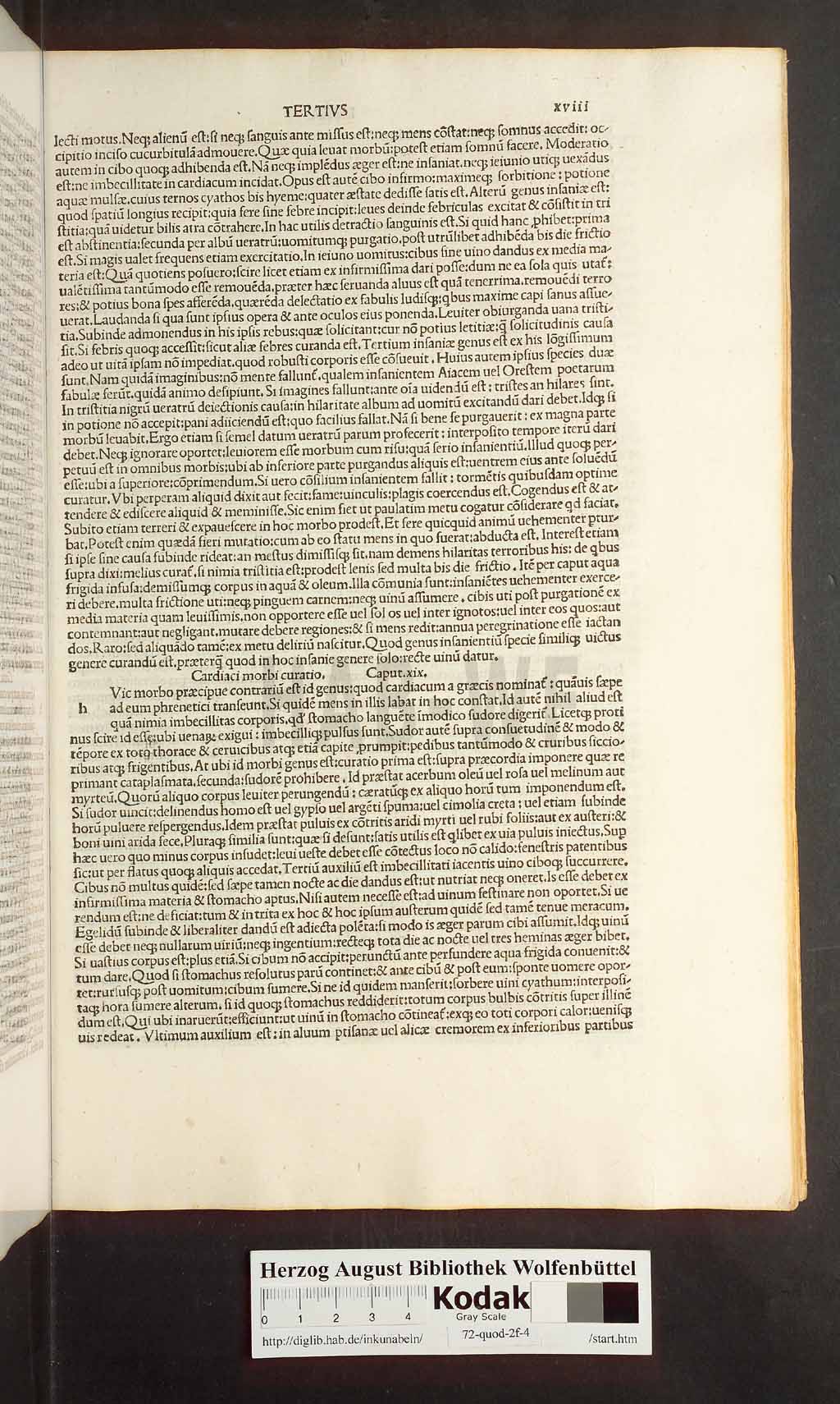 http://diglib.hab.de/inkunabeln/72-quod-2f-4/00035.jpg