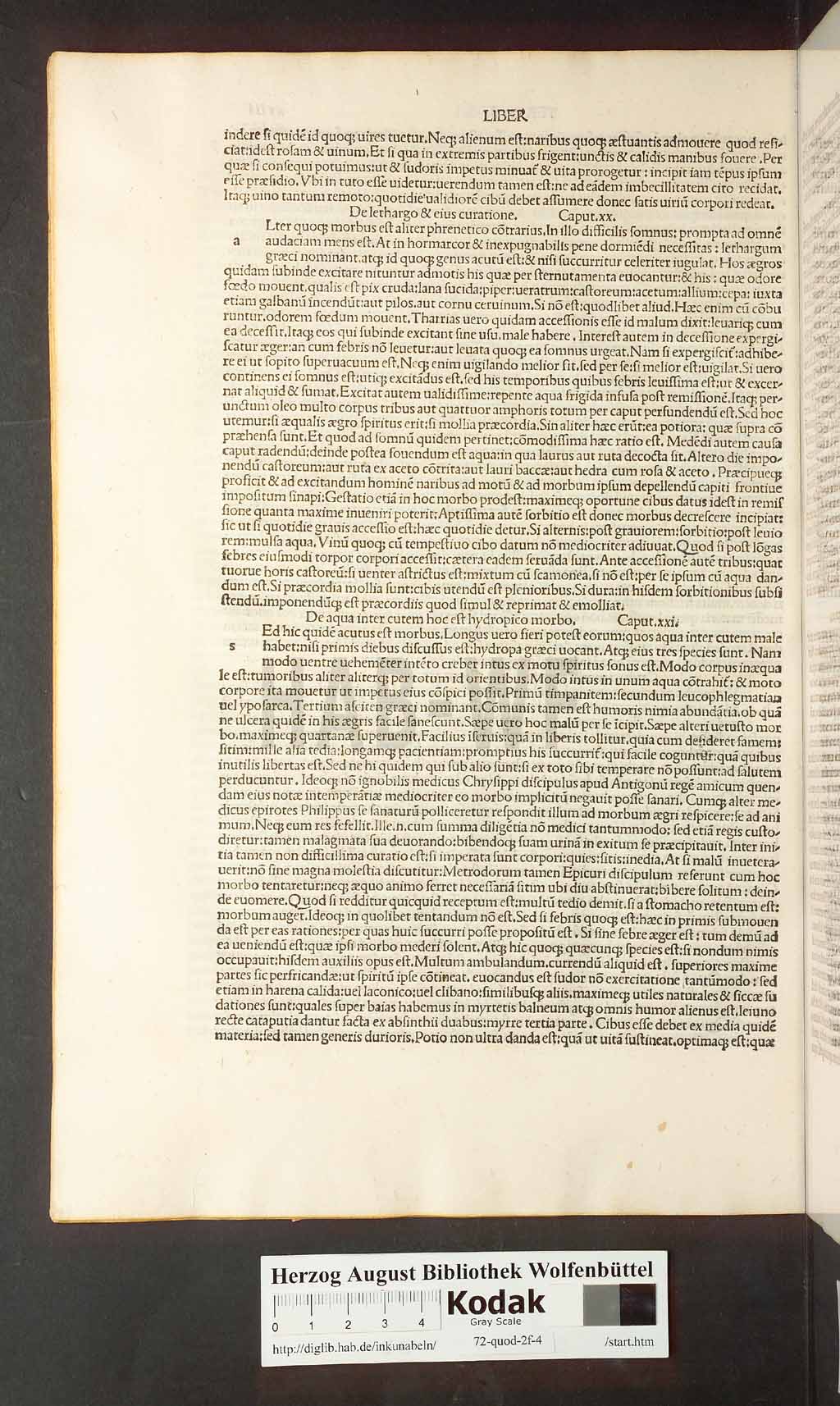 http://diglib.hab.de/inkunabeln/72-quod-2f-4/00036.jpg