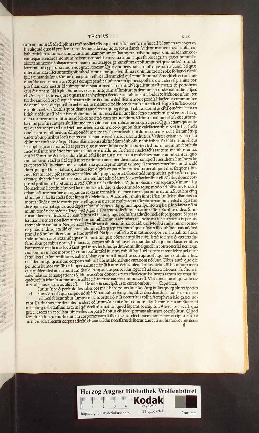 http://diglib.hab.de/inkunabeln/72-quod-2f-4/00037.jpg