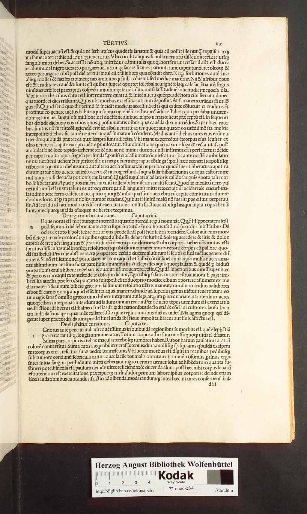 http://diglib.hab.de/inkunabeln/72-quod-2f-4/00039.jpg