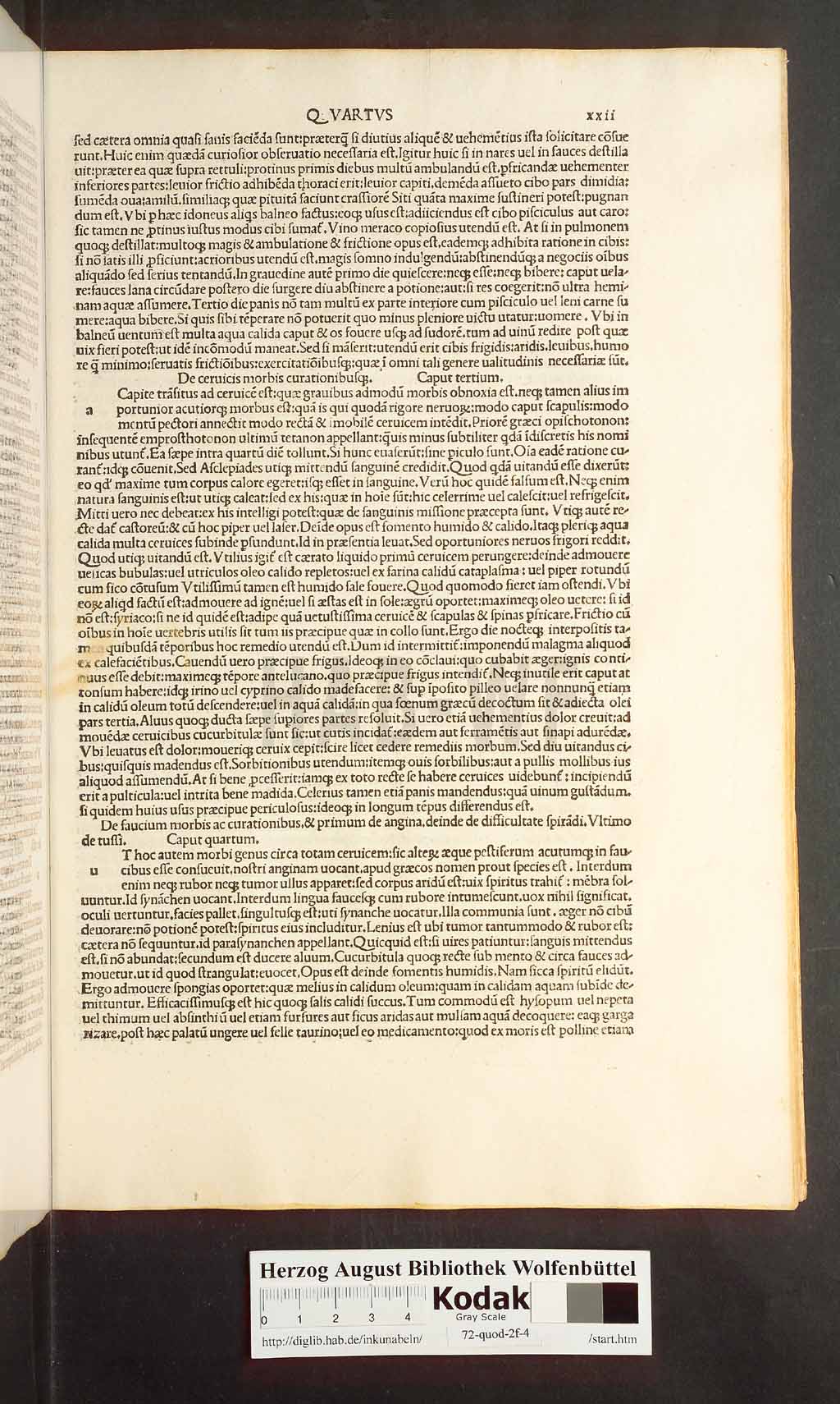 http://diglib.hab.de/inkunabeln/72-quod-2f-4/00043.jpg