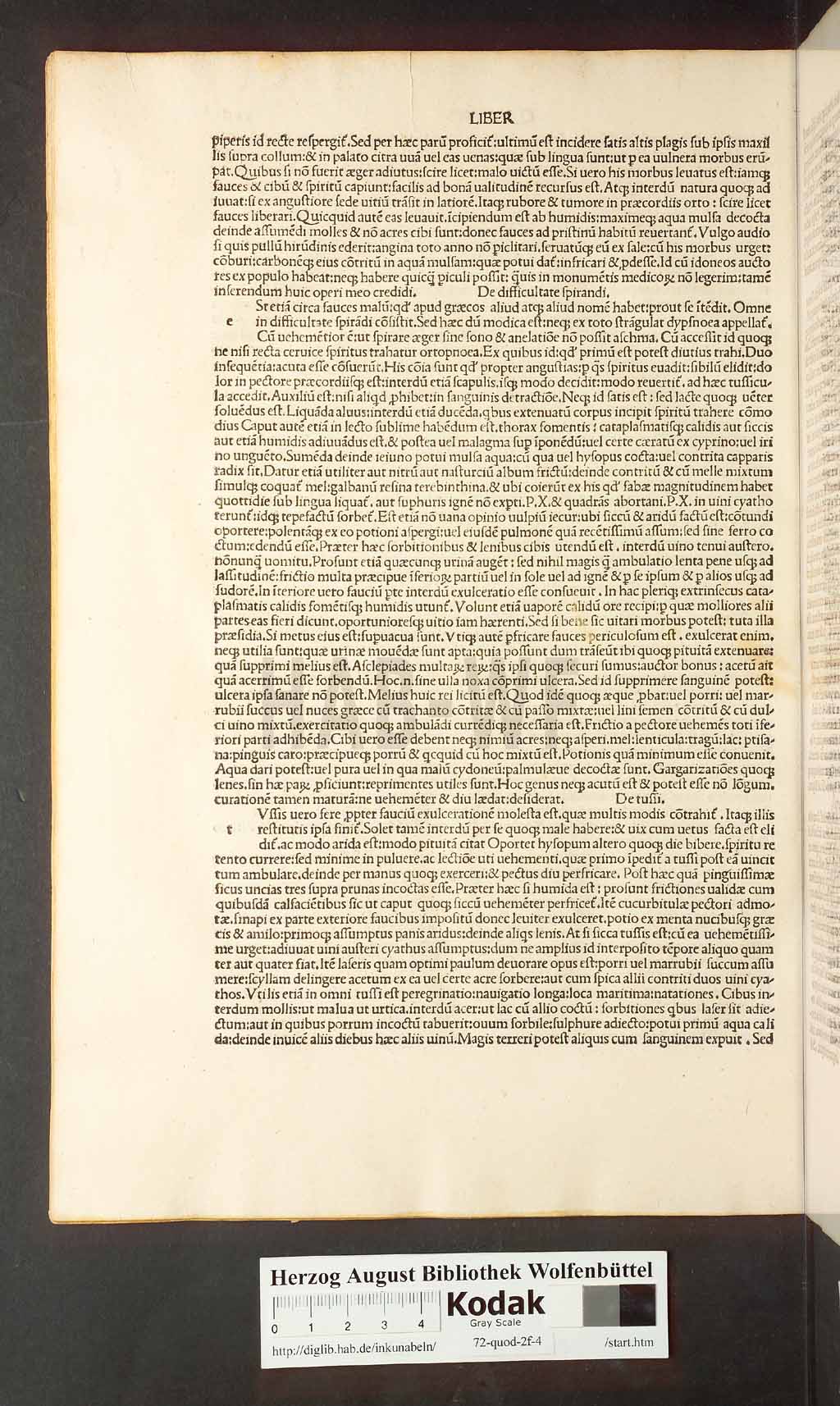 http://diglib.hab.de/inkunabeln/72-quod-2f-4/00044.jpg