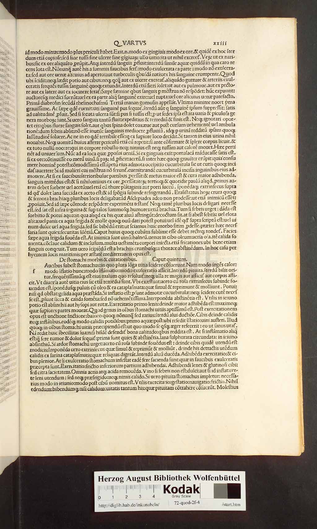 http://diglib.hab.de/inkunabeln/72-quod-2f-4/00045.jpg