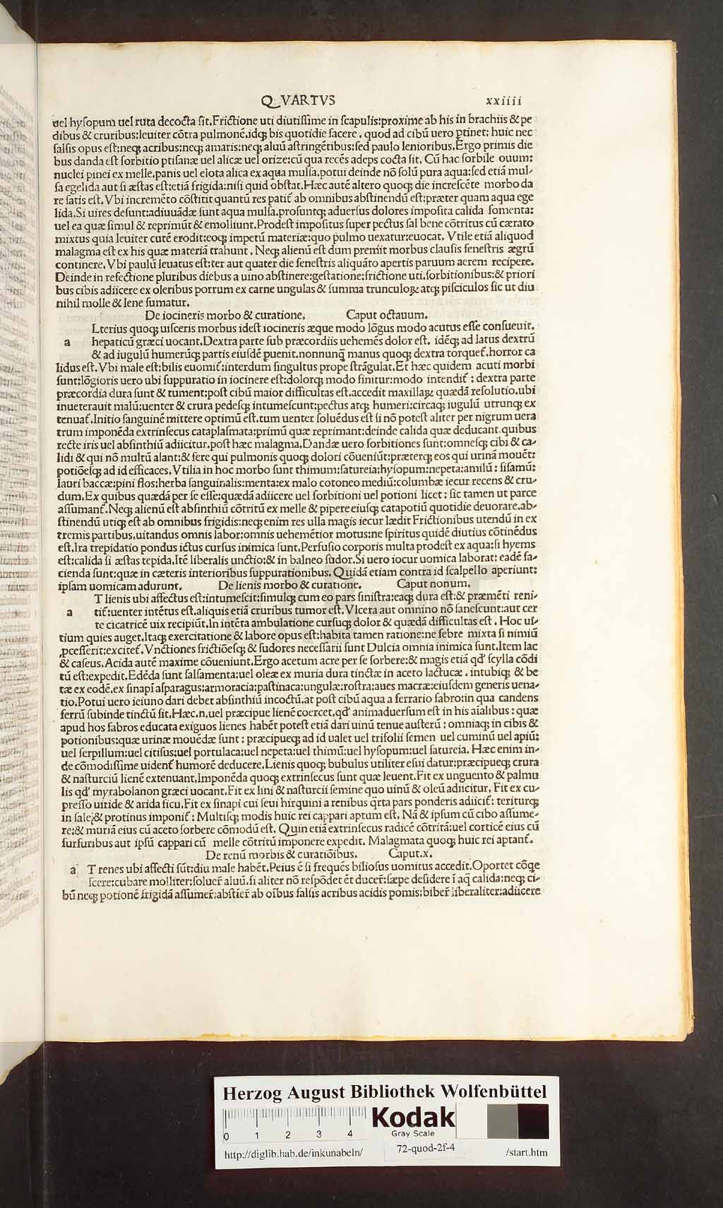 http://diglib.hab.de/inkunabeln/72-quod-2f-4/00047.jpg