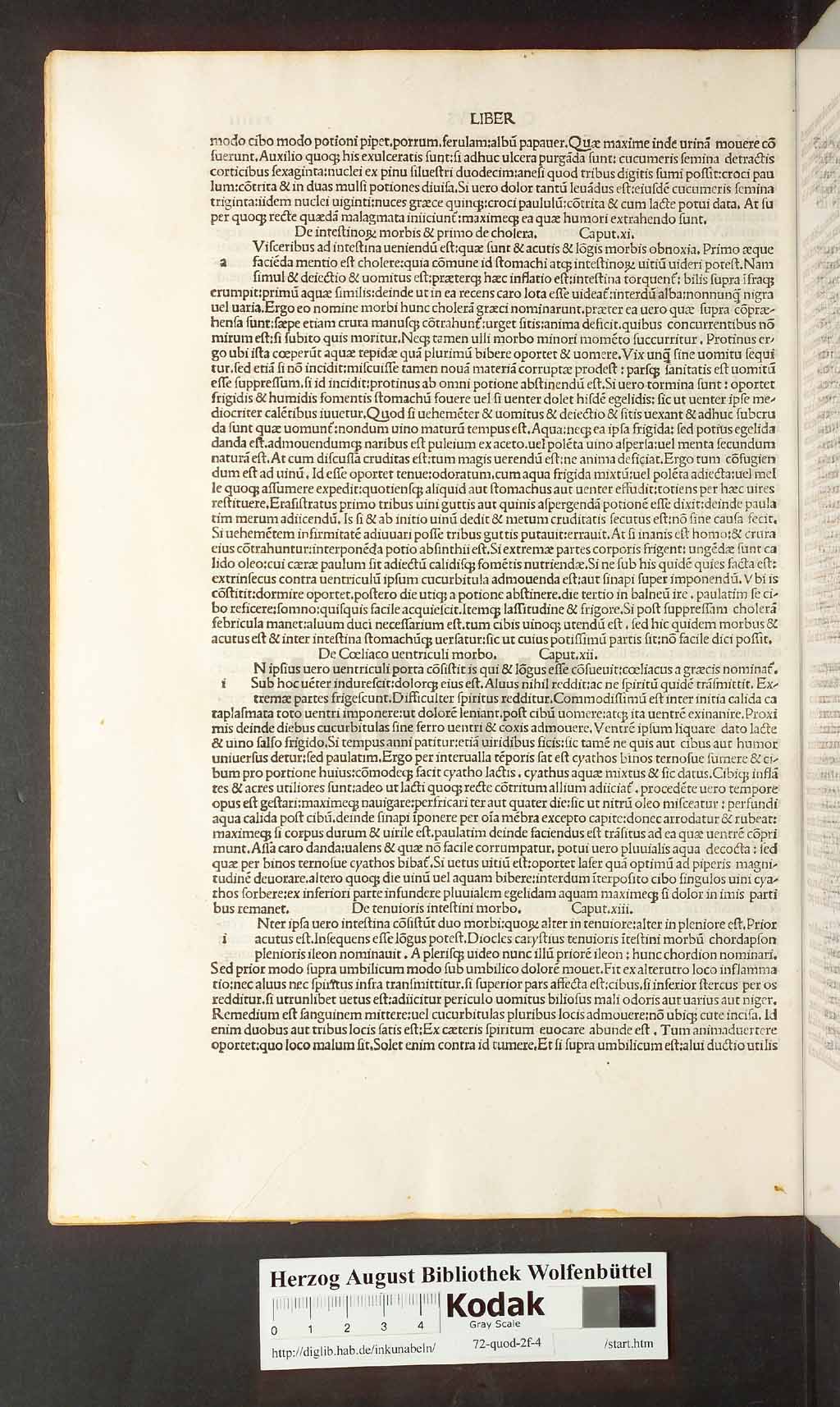 http://diglib.hab.de/inkunabeln/72-quod-2f-4/00048.jpg