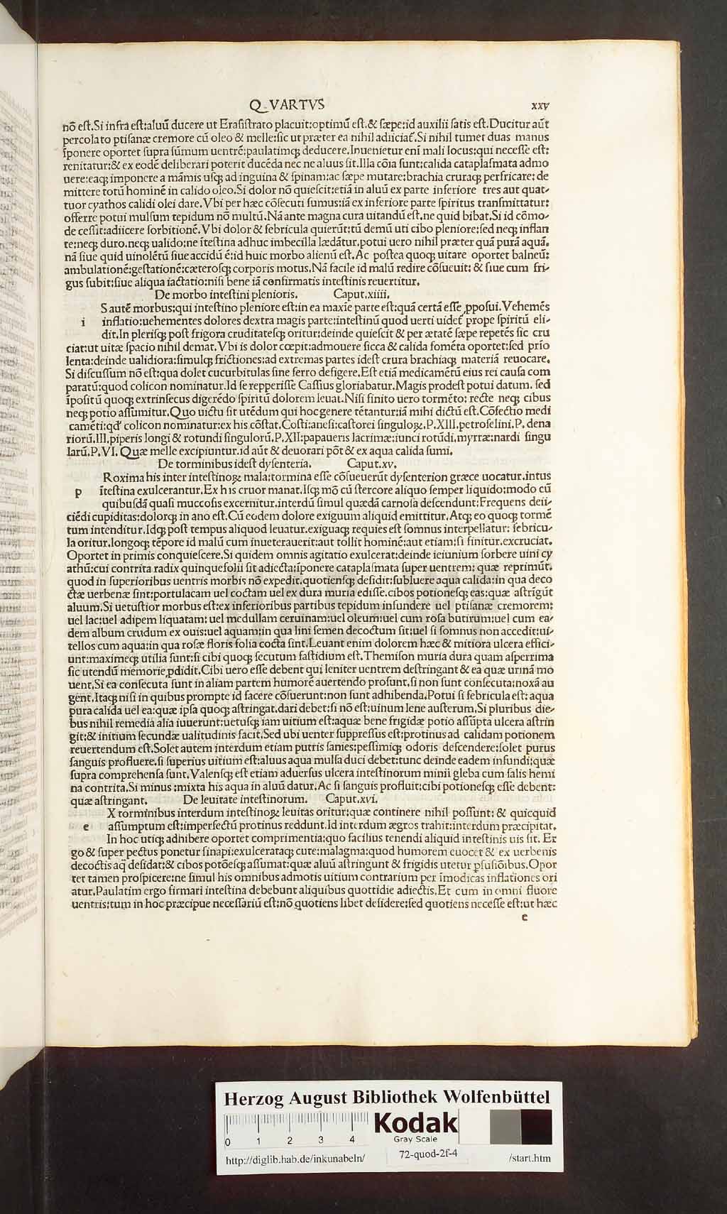 http://diglib.hab.de/inkunabeln/72-quod-2f-4/00049.jpg