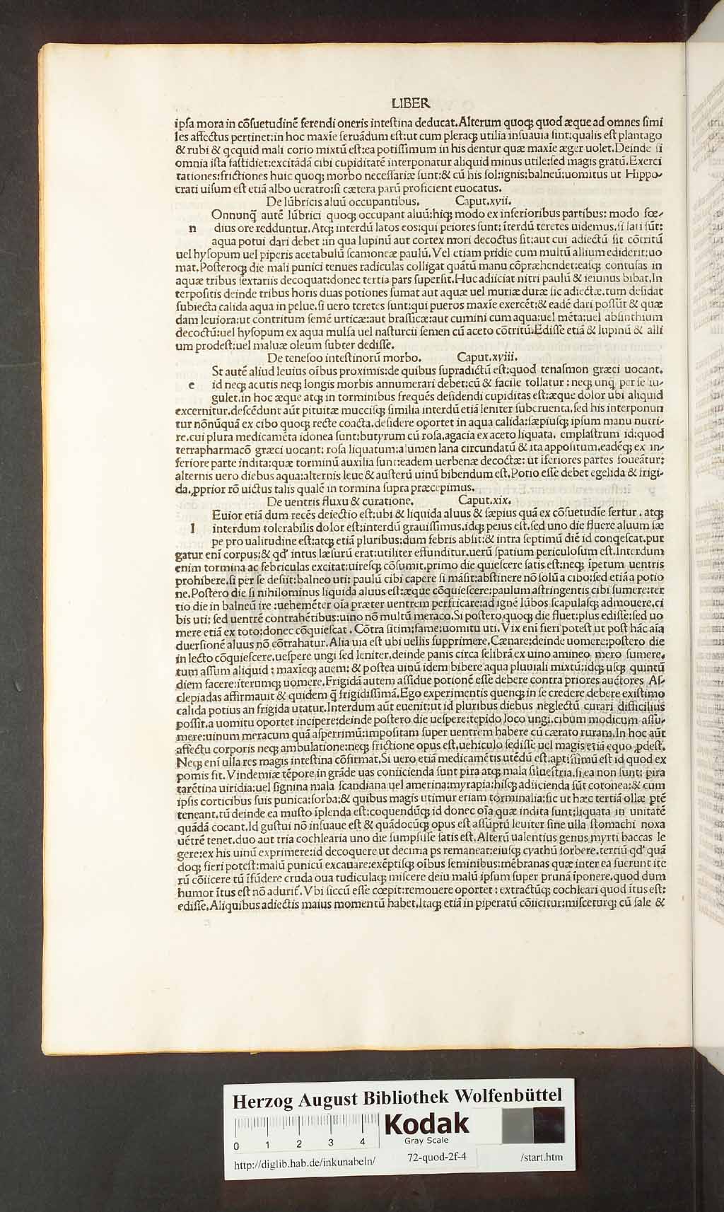 http://diglib.hab.de/inkunabeln/72-quod-2f-4/00050.jpg