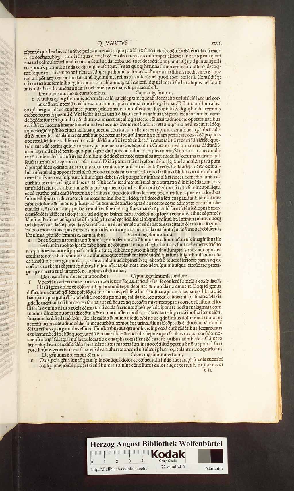 http://diglib.hab.de/inkunabeln/72-quod-2f-4/00051.jpg