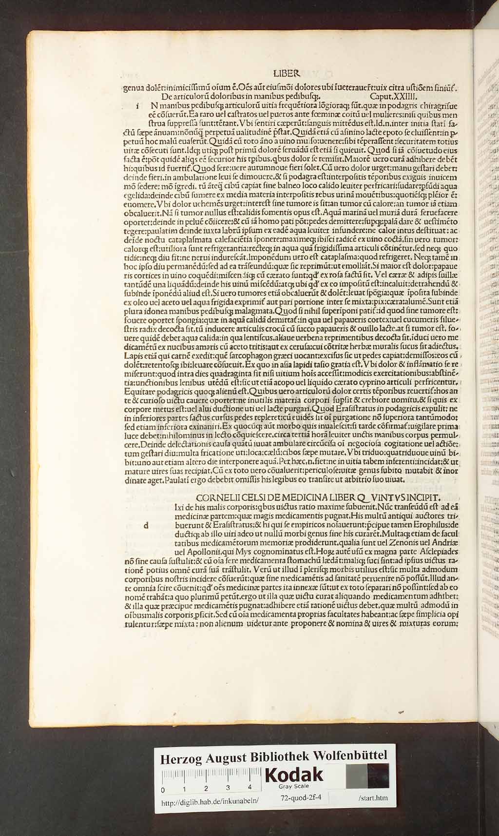 http://diglib.hab.de/inkunabeln/72-quod-2f-4/00052.jpg