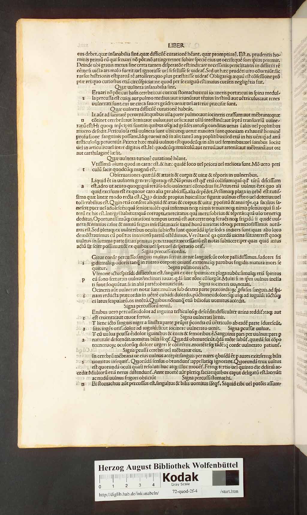 http://diglib.hab.de/inkunabeln/72-quod-2f-4/00062.jpg