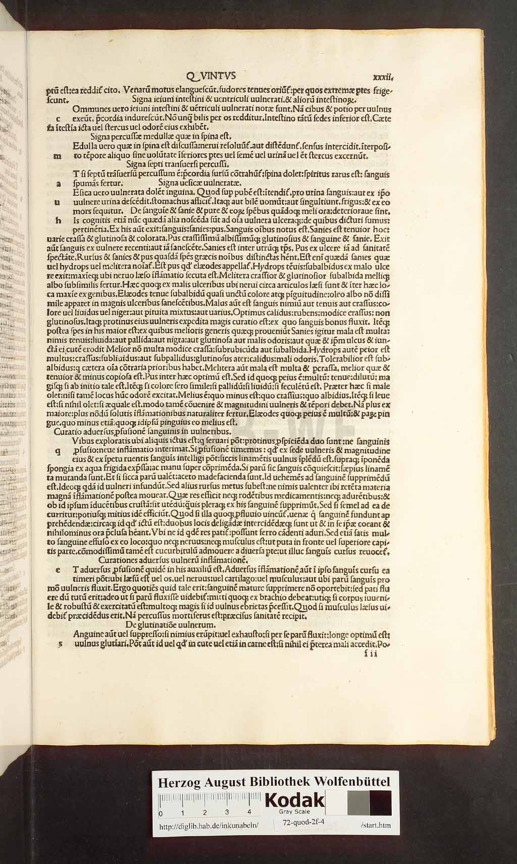 http://diglib.hab.de/inkunabeln/72-quod-2f-4/00063.jpg