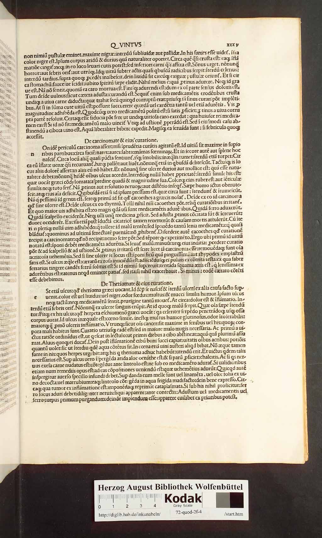 http://diglib.hab.de/inkunabeln/72-quod-2f-4/00069.jpg