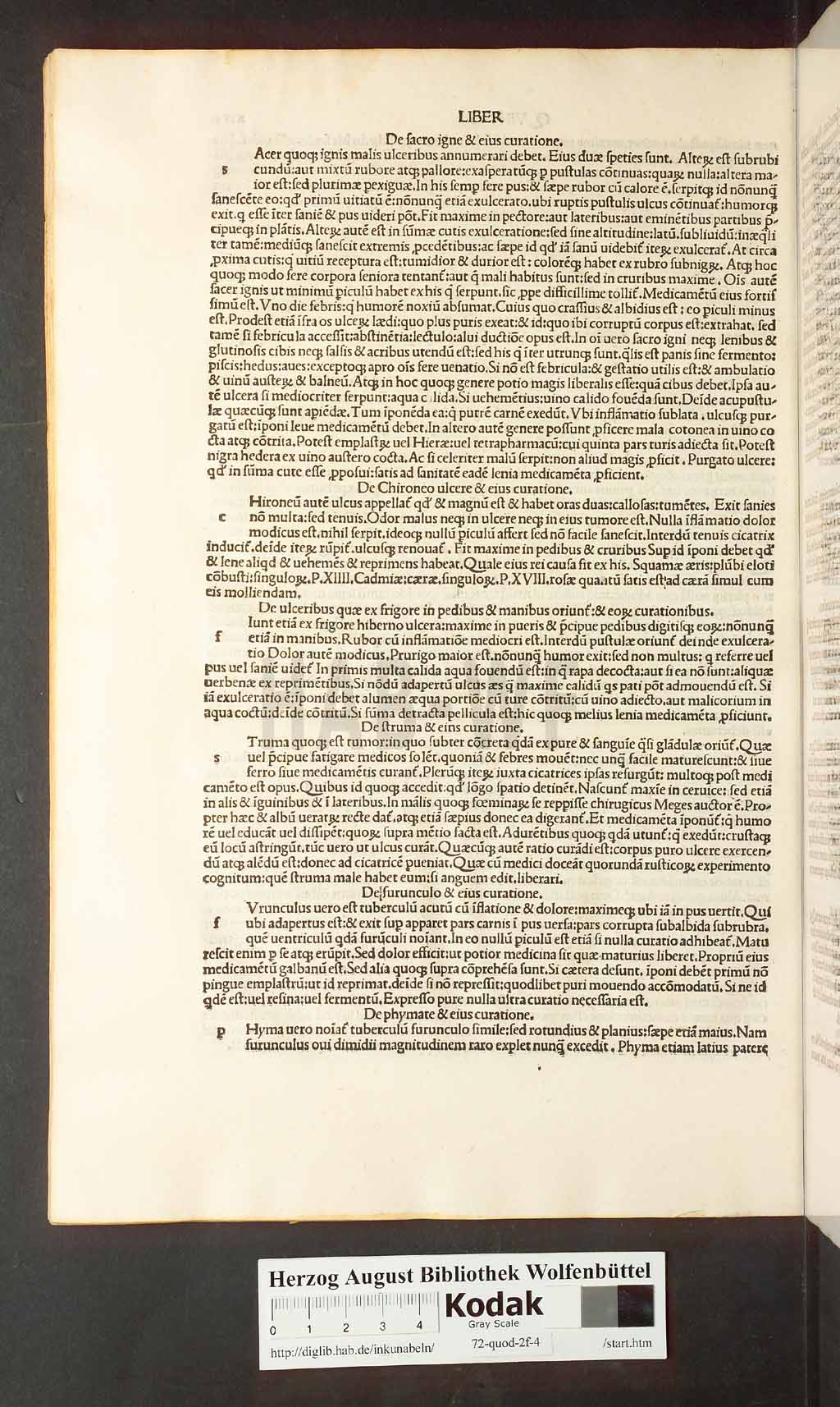 http://diglib.hab.de/inkunabeln/72-quod-2f-4/00070.jpg