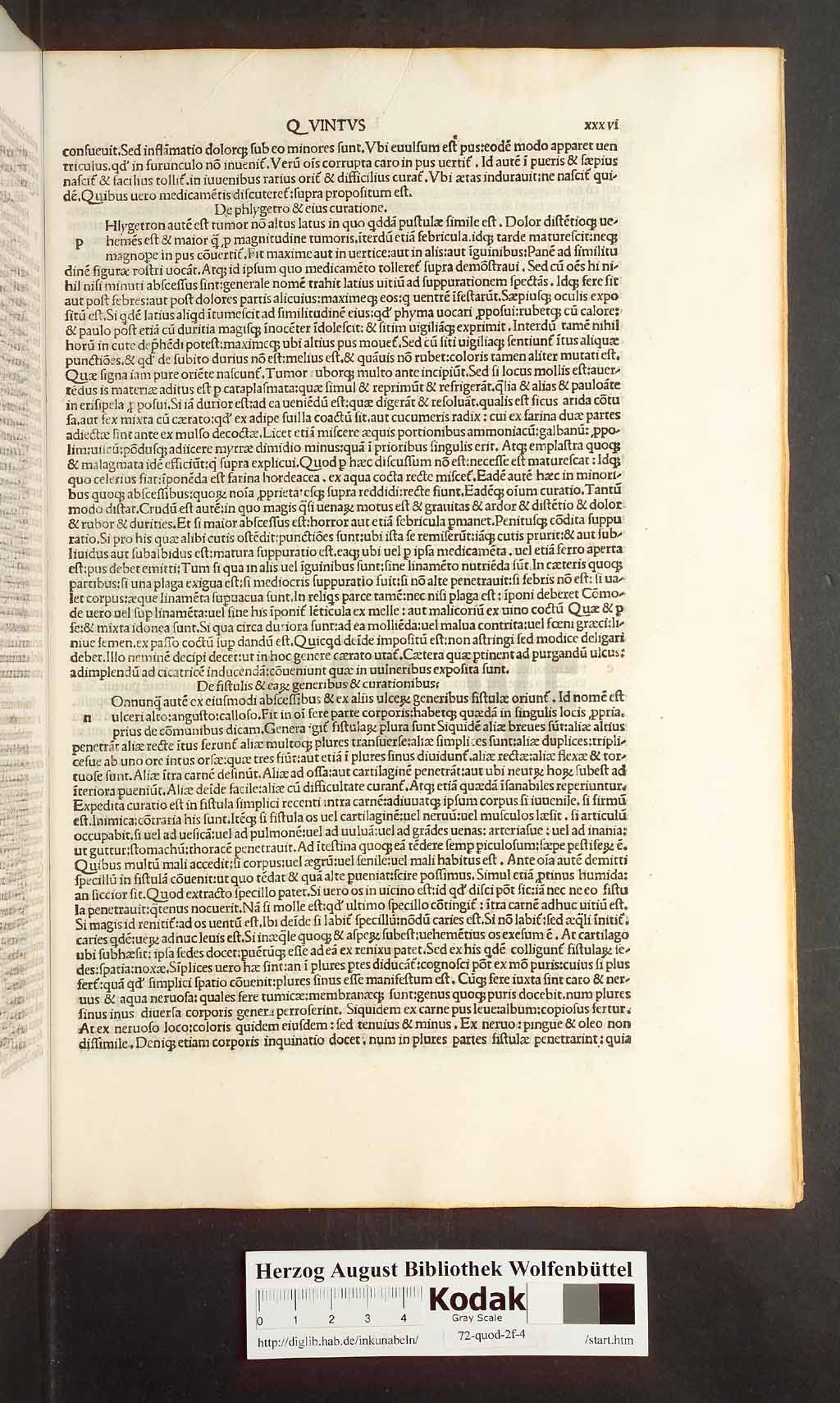 http://diglib.hab.de/inkunabeln/72-quod-2f-4/00071.jpg