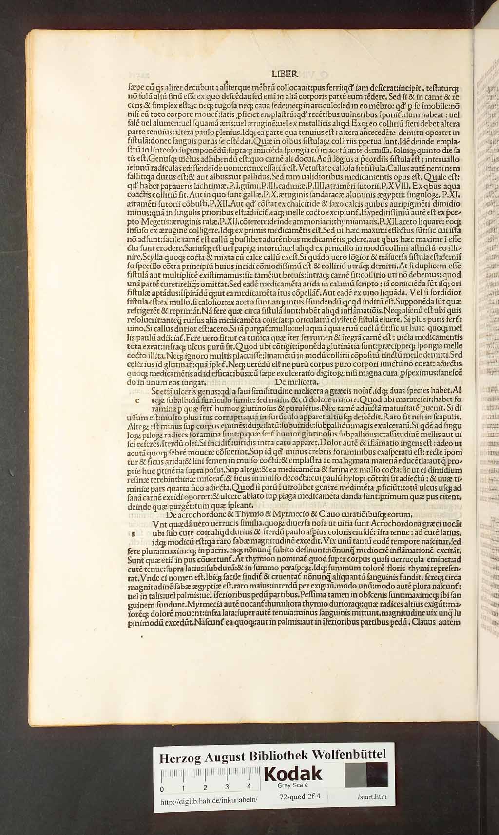 http://diglib.hab.de/inkunabeln/72-quod-2f-4/00072.jpg