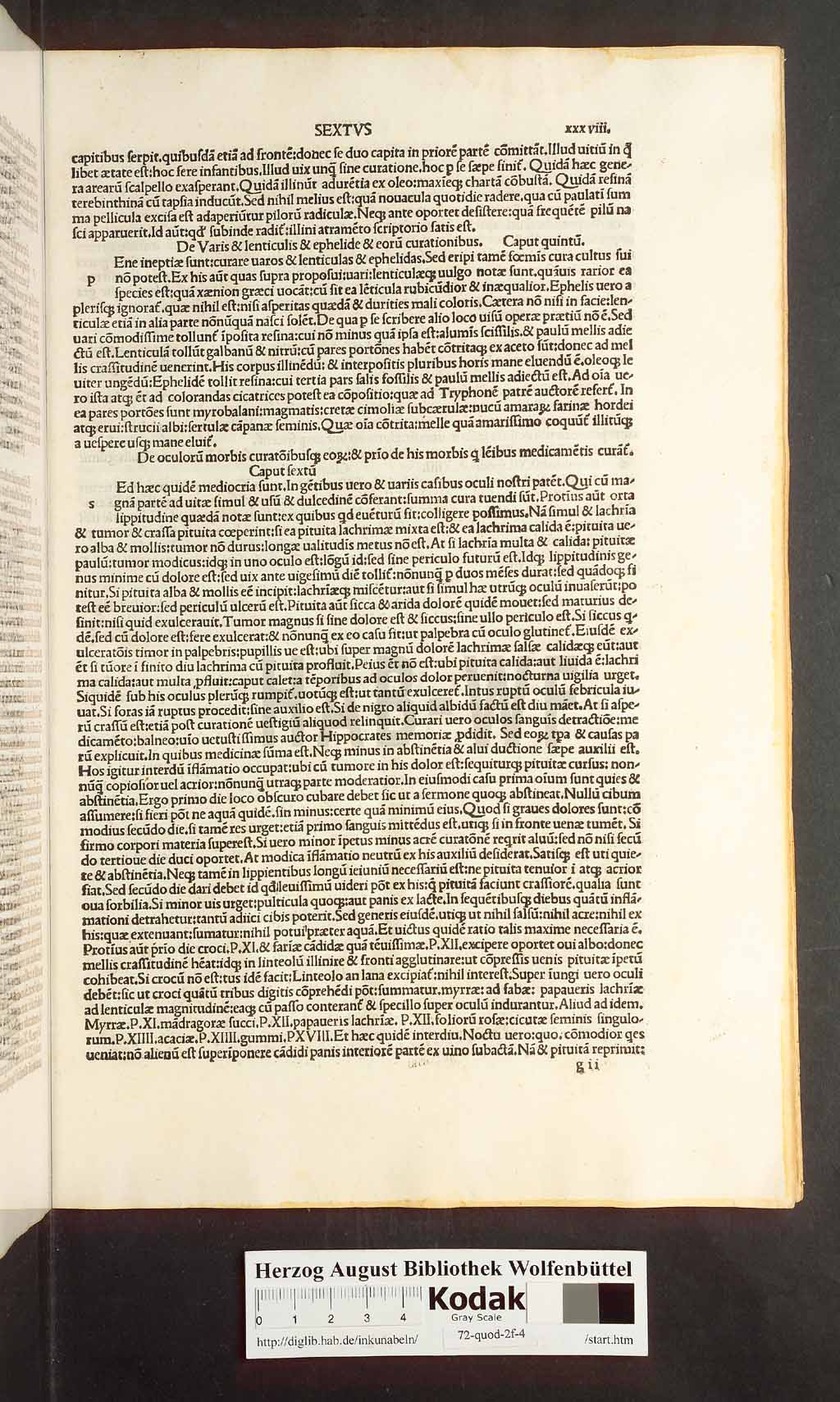 http://diglib.hab.de/inkunabeln/72-quod-2f-4/00075.jpg