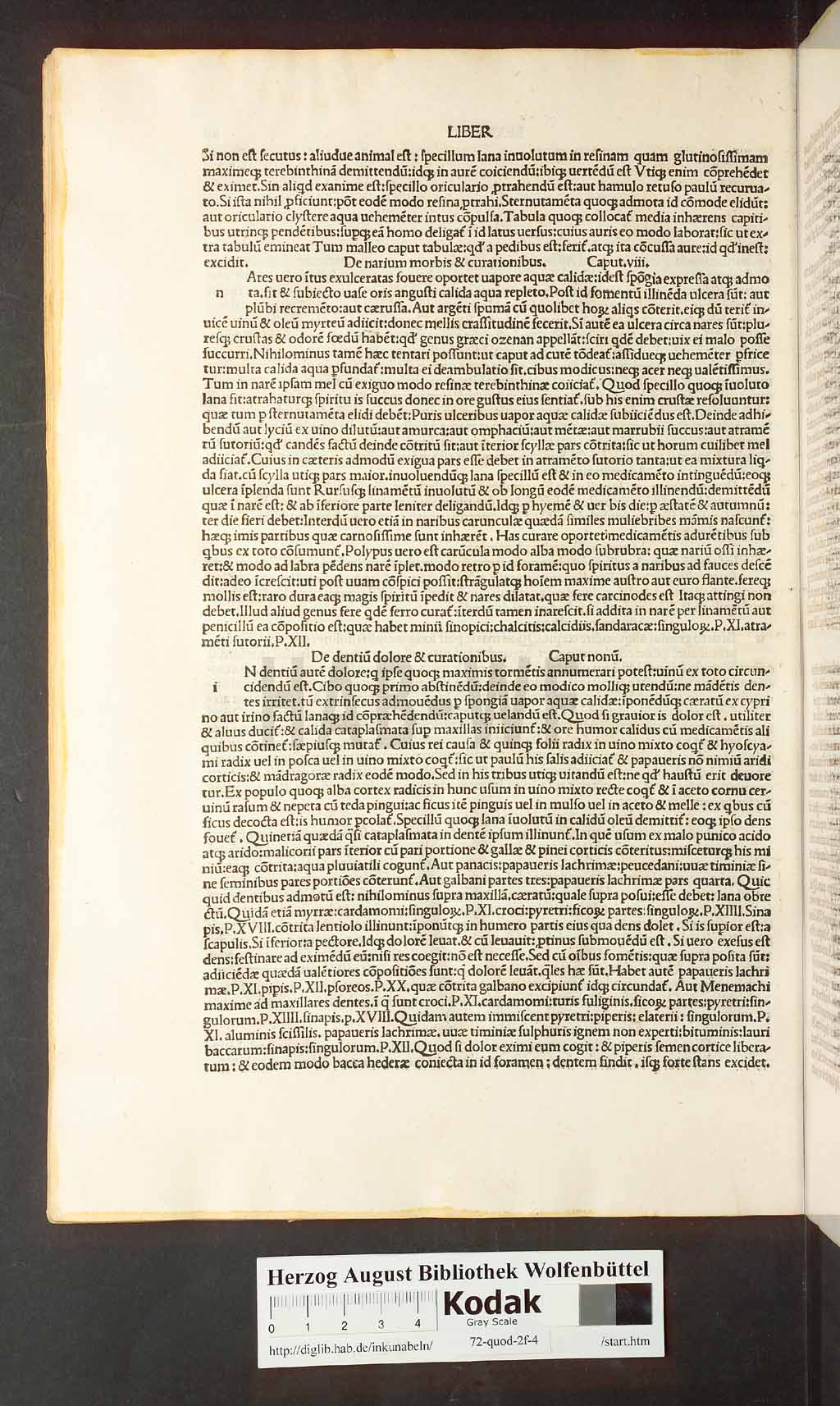 http://diglib.hab.de/inkunabeln/72-quod-2f-4/00082.jpg