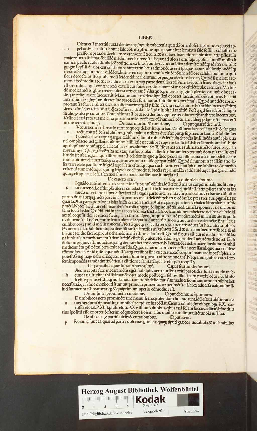 http://diglib.hab.de/inkunabeln/72-quod-2f-4/00084.jpg