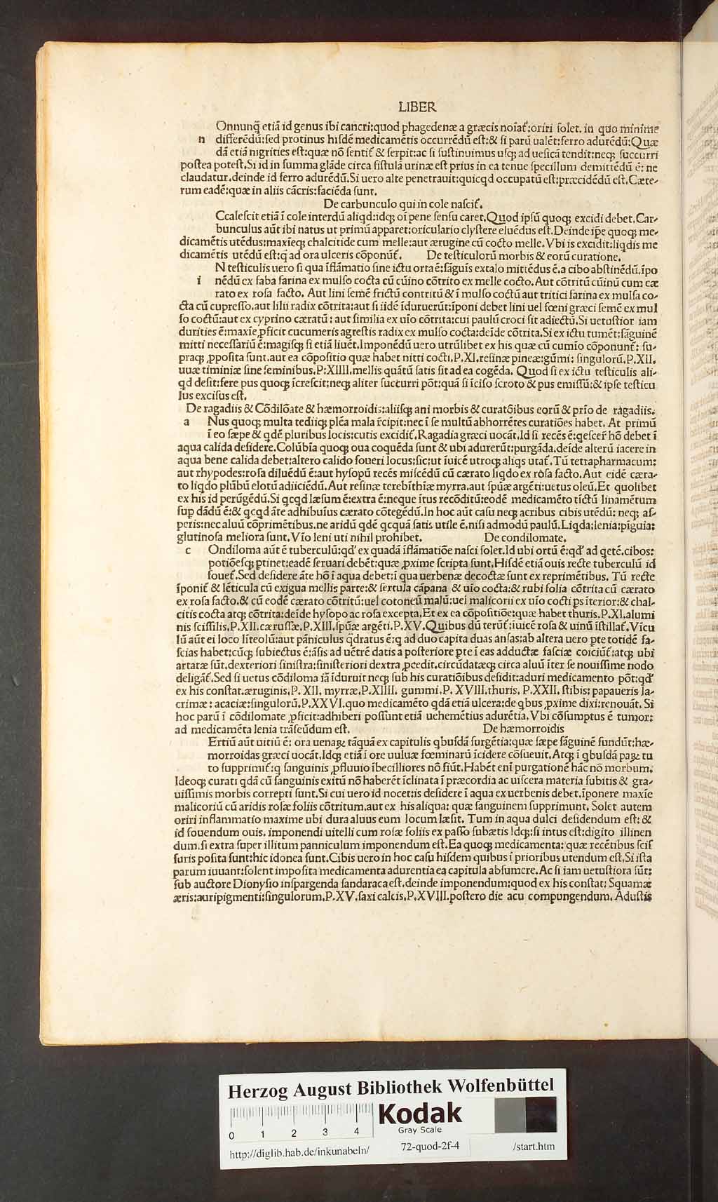 http://diglib.hab.de/inkunabeln/72-quod-2f-4/00086.jpg