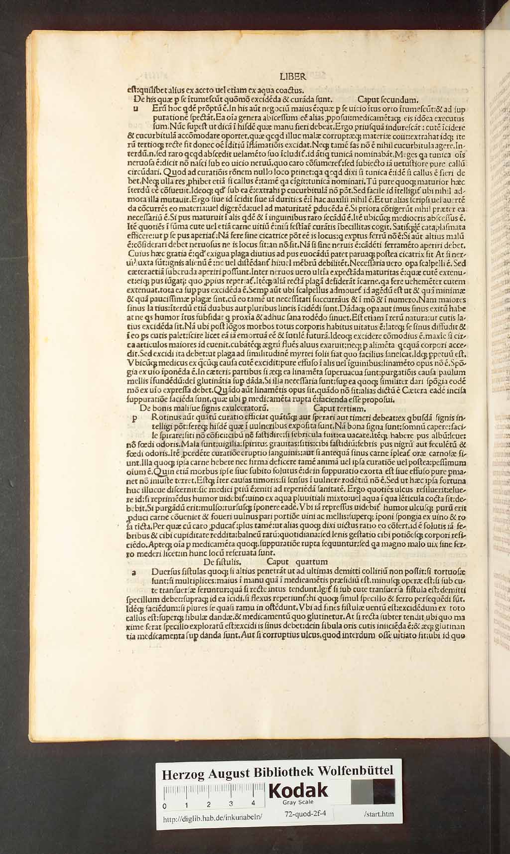 http://diglib.hab.de/inkunabeln/72-quod-2f-4/00088.jpg