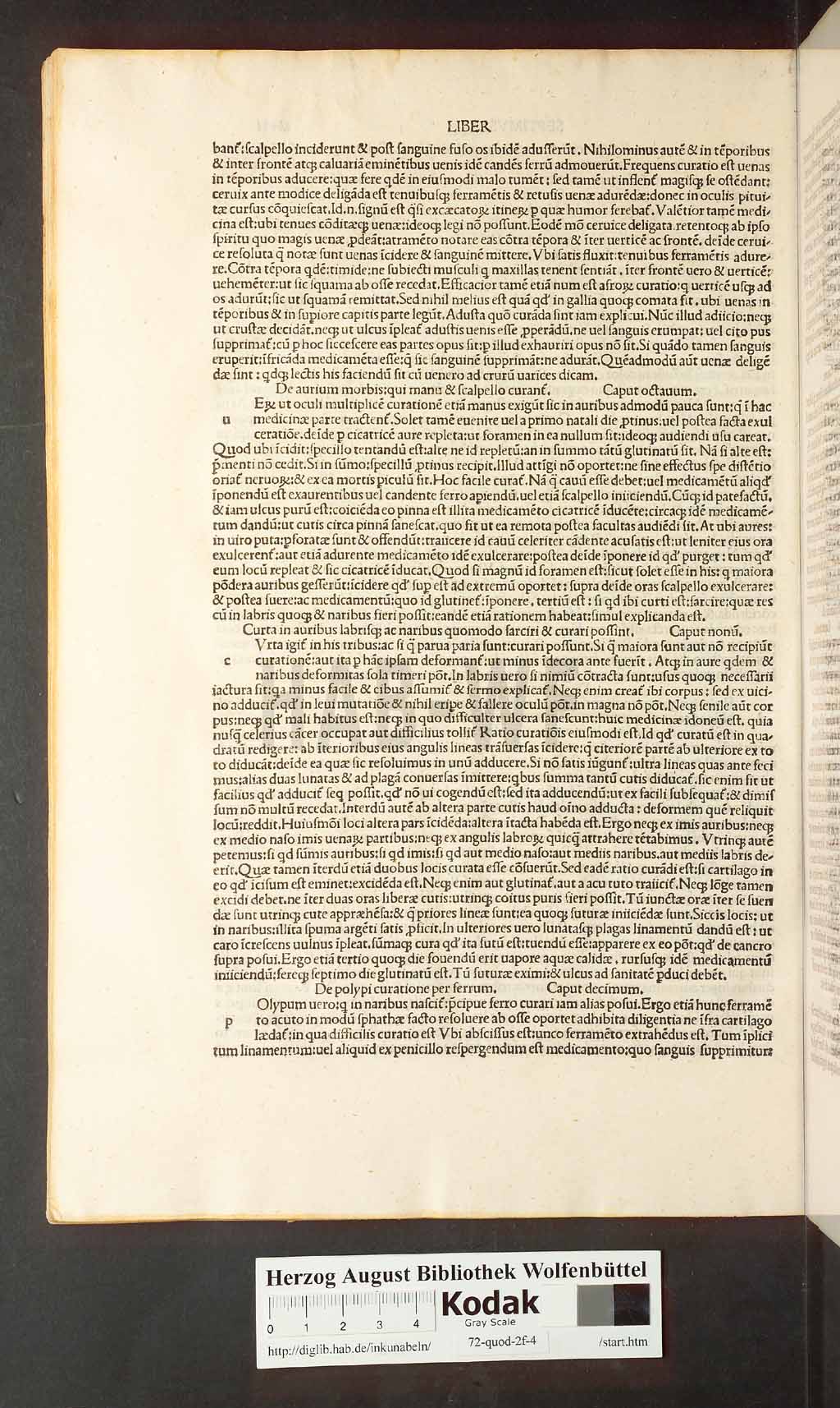 http://diglib.hab.de/inkunabeln/72-quod-2f-4/00094.jpg