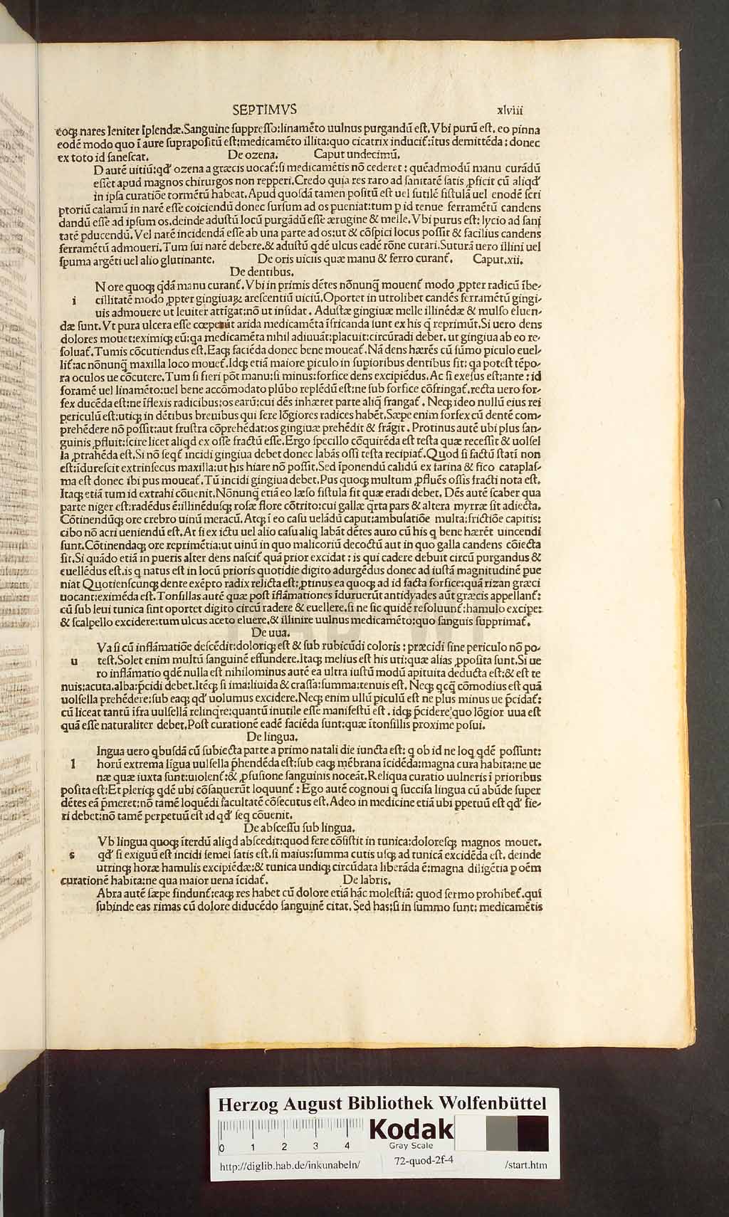 http://diglib.hab.de/inkunabeln/72-quod-2f-4/00095.jpg