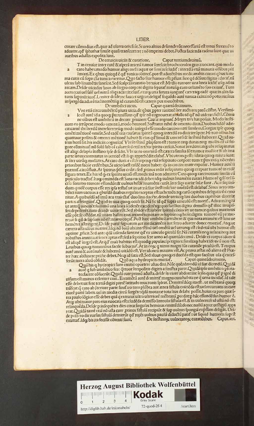 http://diglib.hab.de/inkunabeln/72-quod-2f-4/00096.jpg