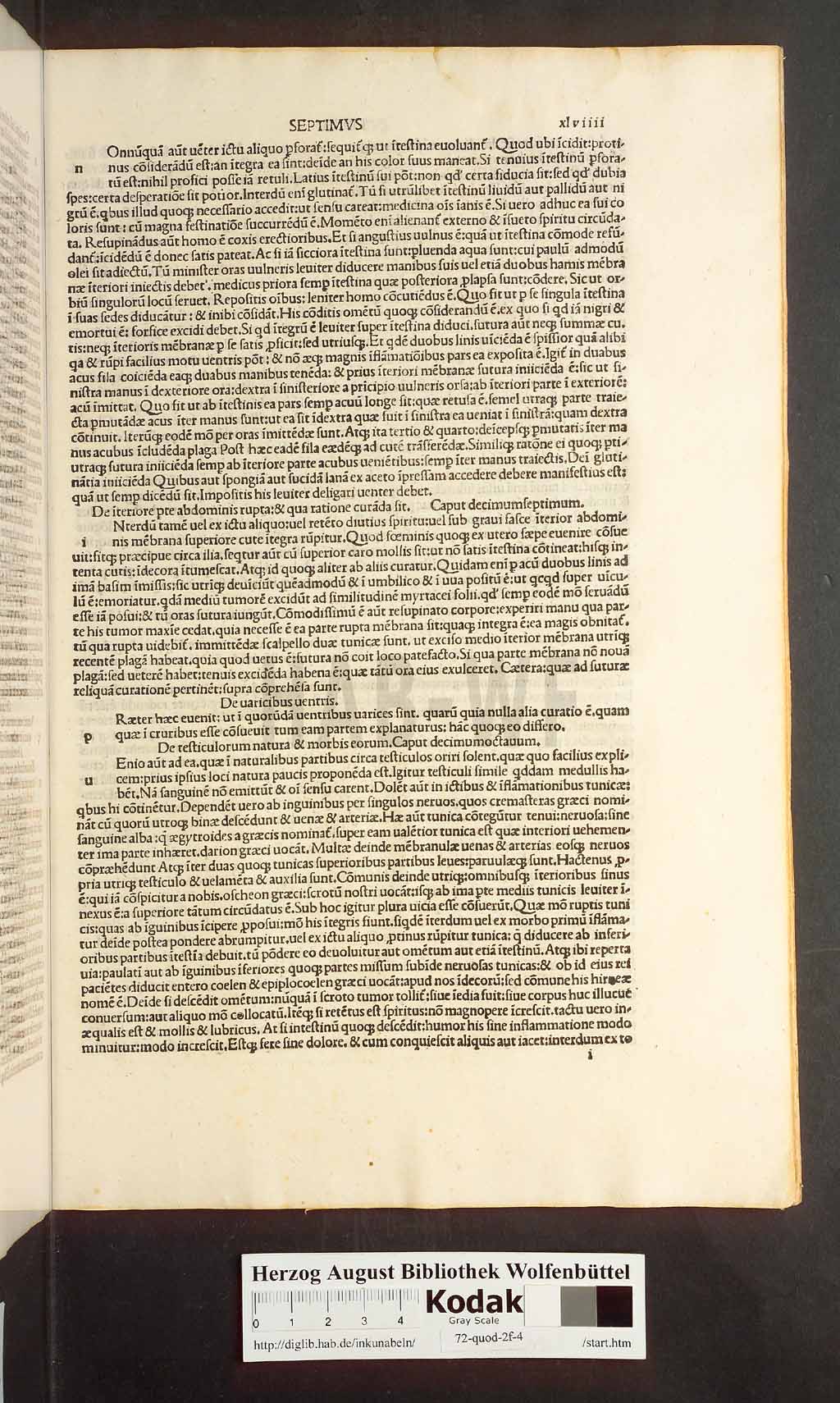 http://diglib.hab.de/inkunabeln/72-quod-2f-4/00097.jpg