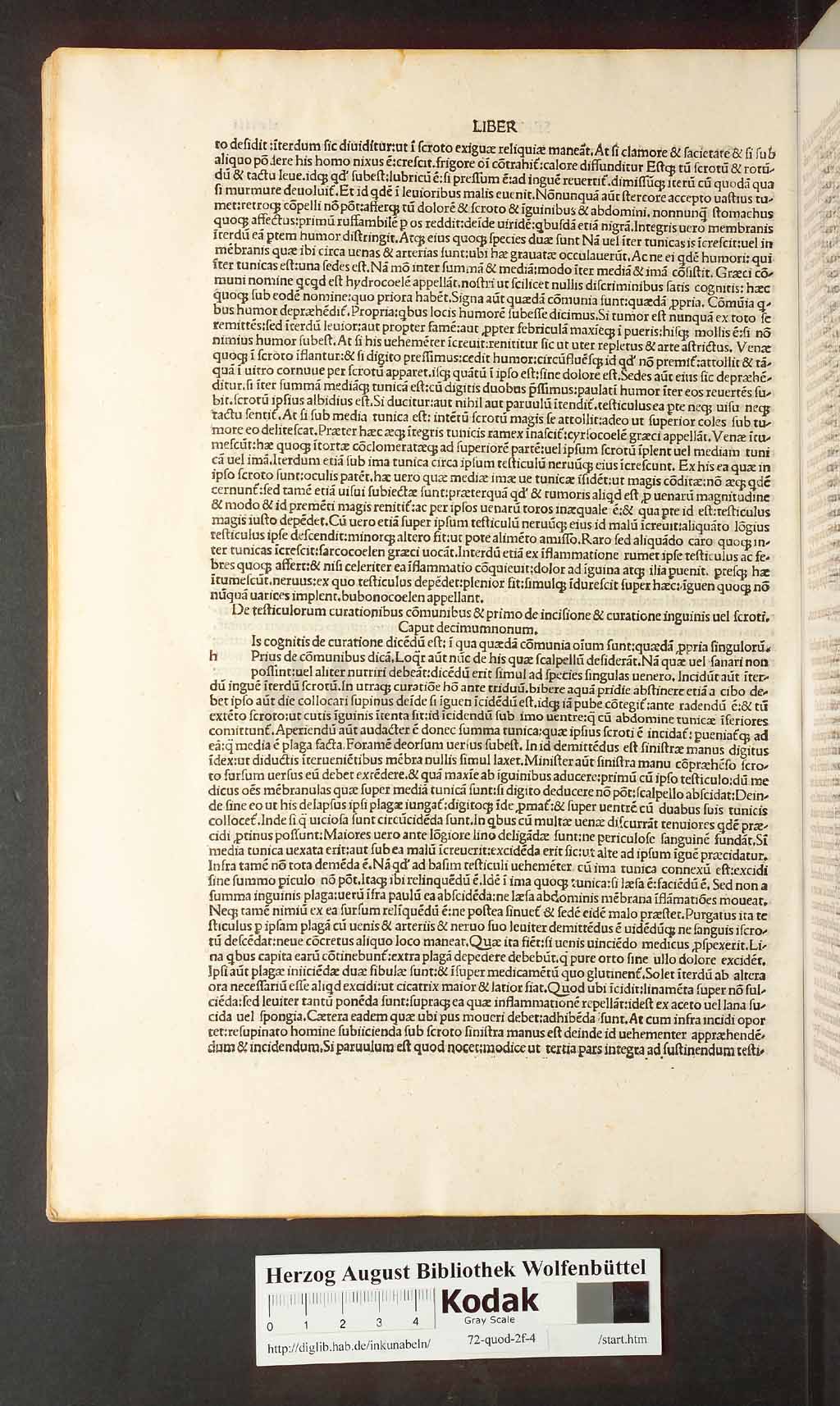 http://diglib.hab.de/inkunabeln/72-quod-2f-4/00098.jpg