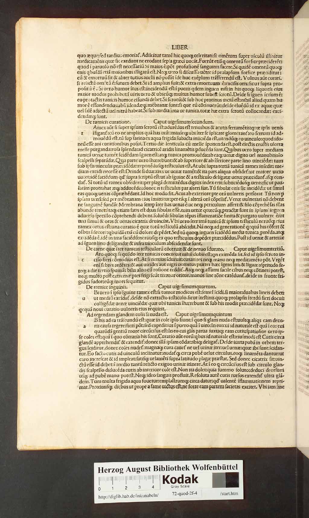 http://diglib.hab.de/inkunabeln/72-quod-2f-4/00100.jpg