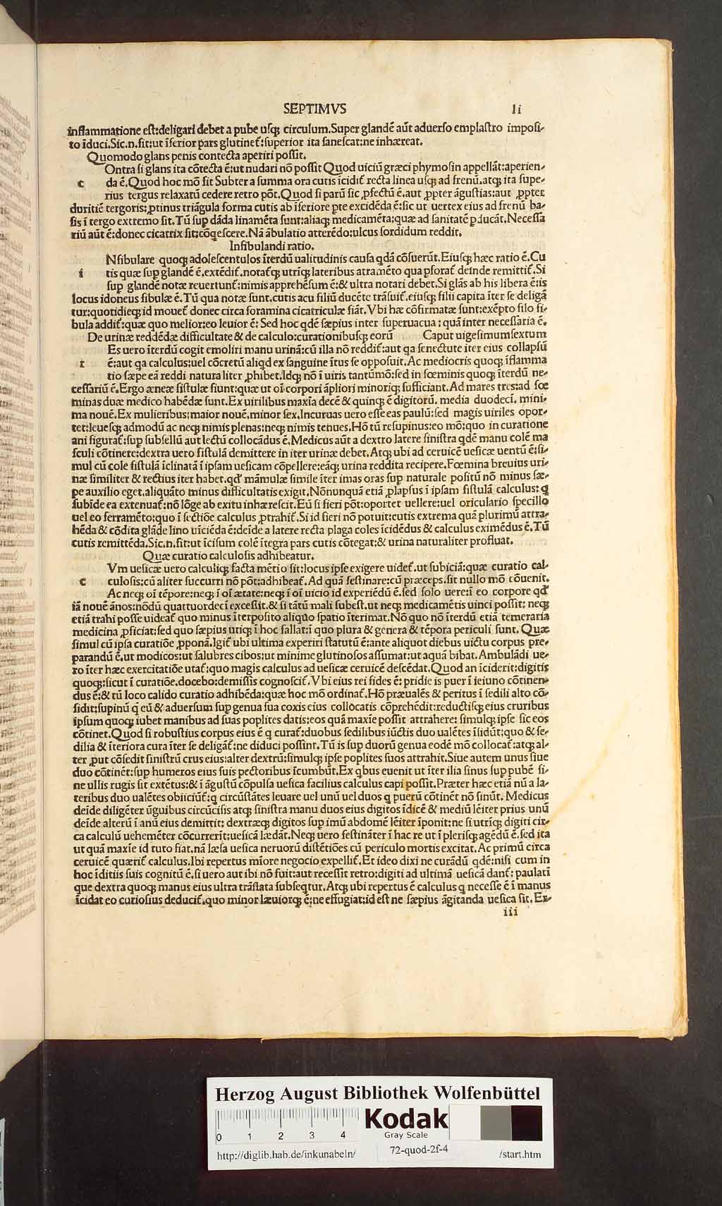 http://diglib.hab.de/inkunabeln/72-quod-2f-4/00101.jpg