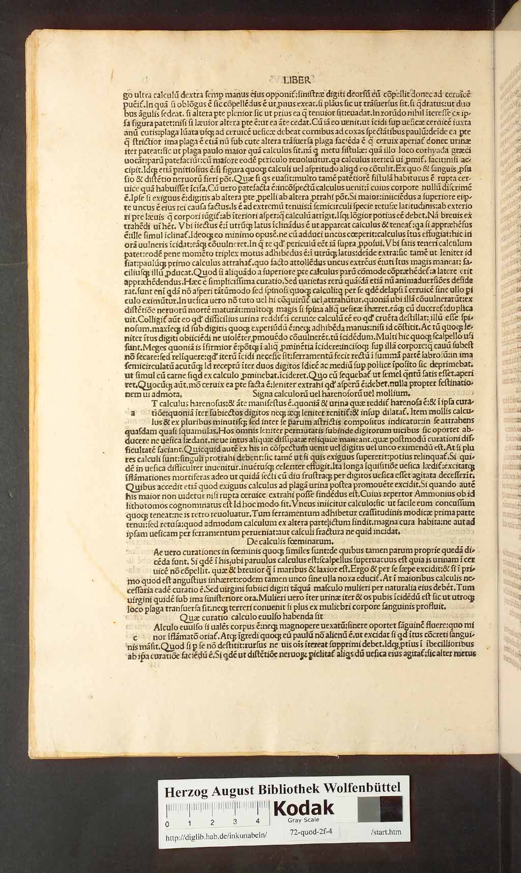 http://diglib.hab.de/inkunabeln/72-quod-2f-4/00102.jpg