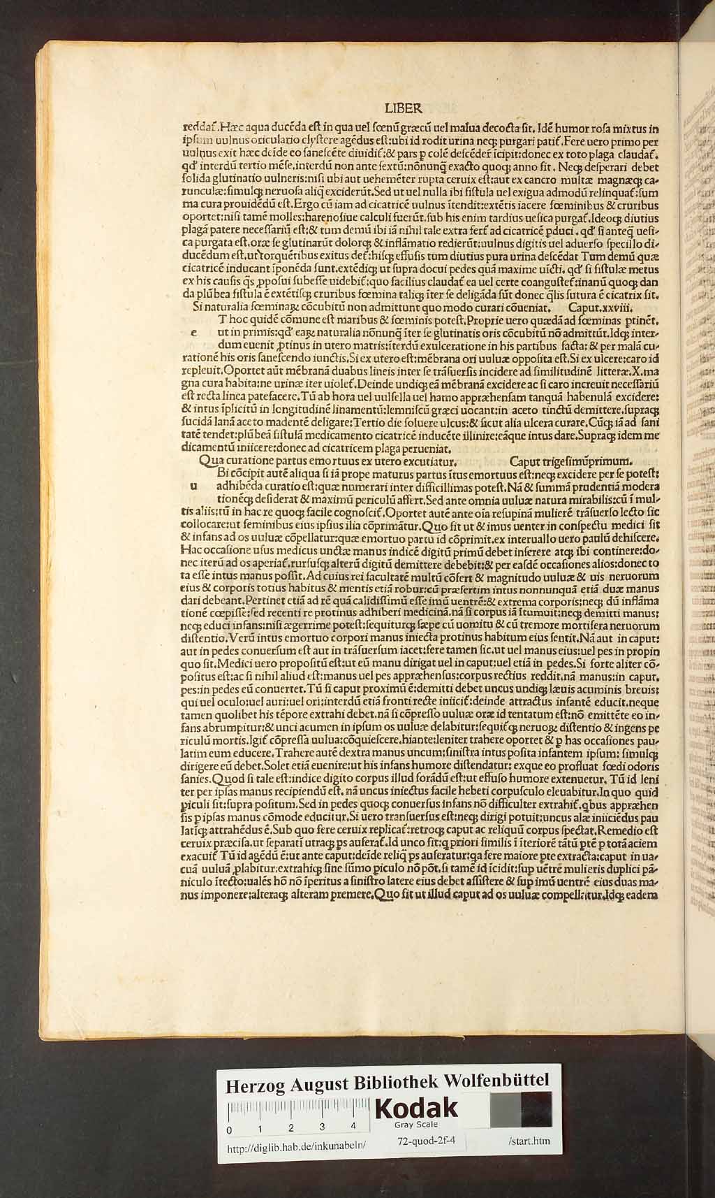 http://diglib.hab.de/inkunabeln/72-quod-2f-4/00104.jpg