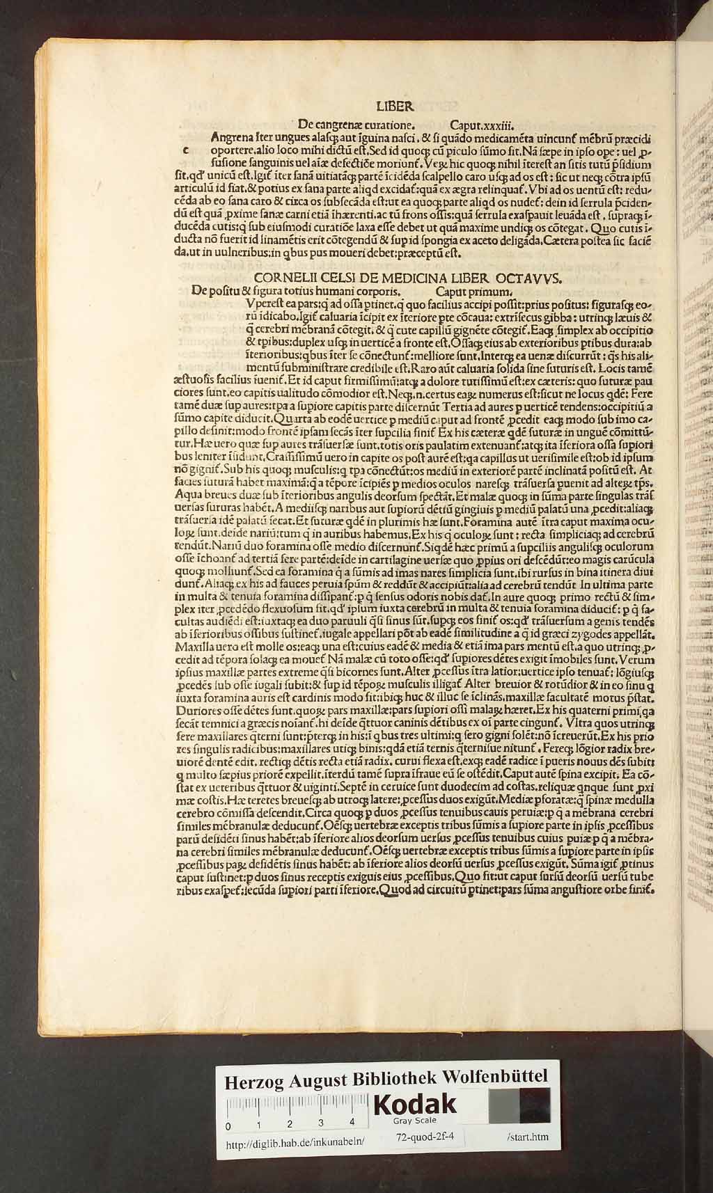 http://diglib.hab.de/inkunabeln/72-quod-2f-4/00106.jpg