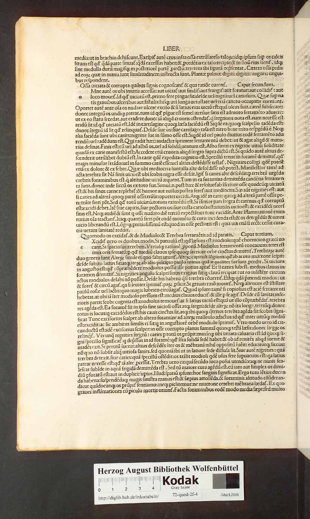 http://diglib.hab.de/inkunabeln/72-quod-2f-4/00108.jpg