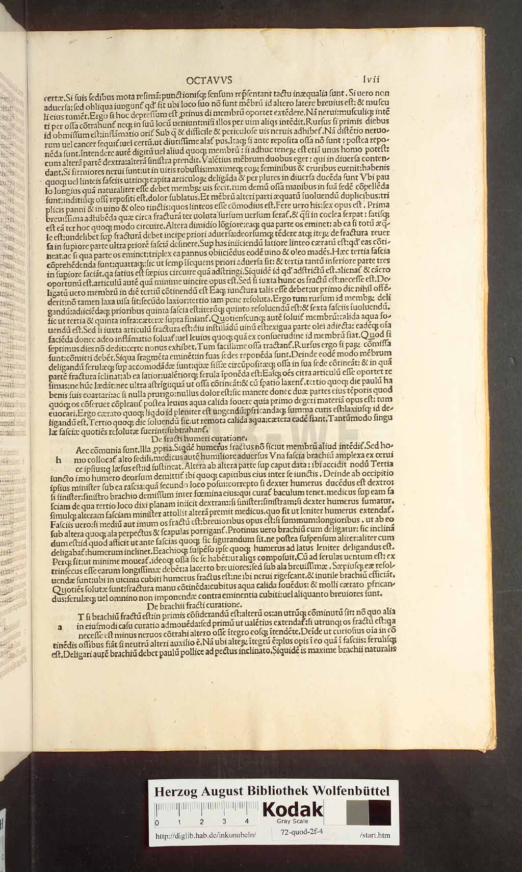 http://diglib.hab.de/inkunabeln/72-quod-2f-4/00113.jpg