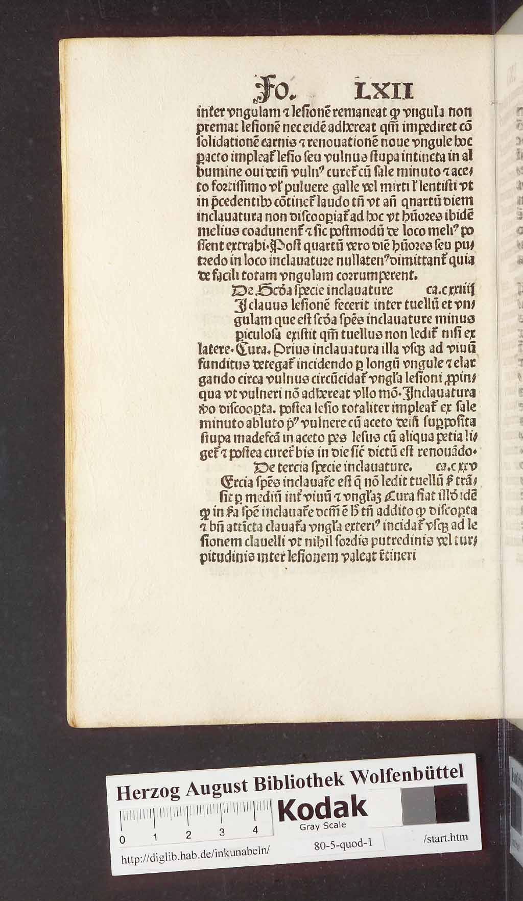 http://diglib.hab.de/inkunabeln/80-5-quod-1/00136.jpg