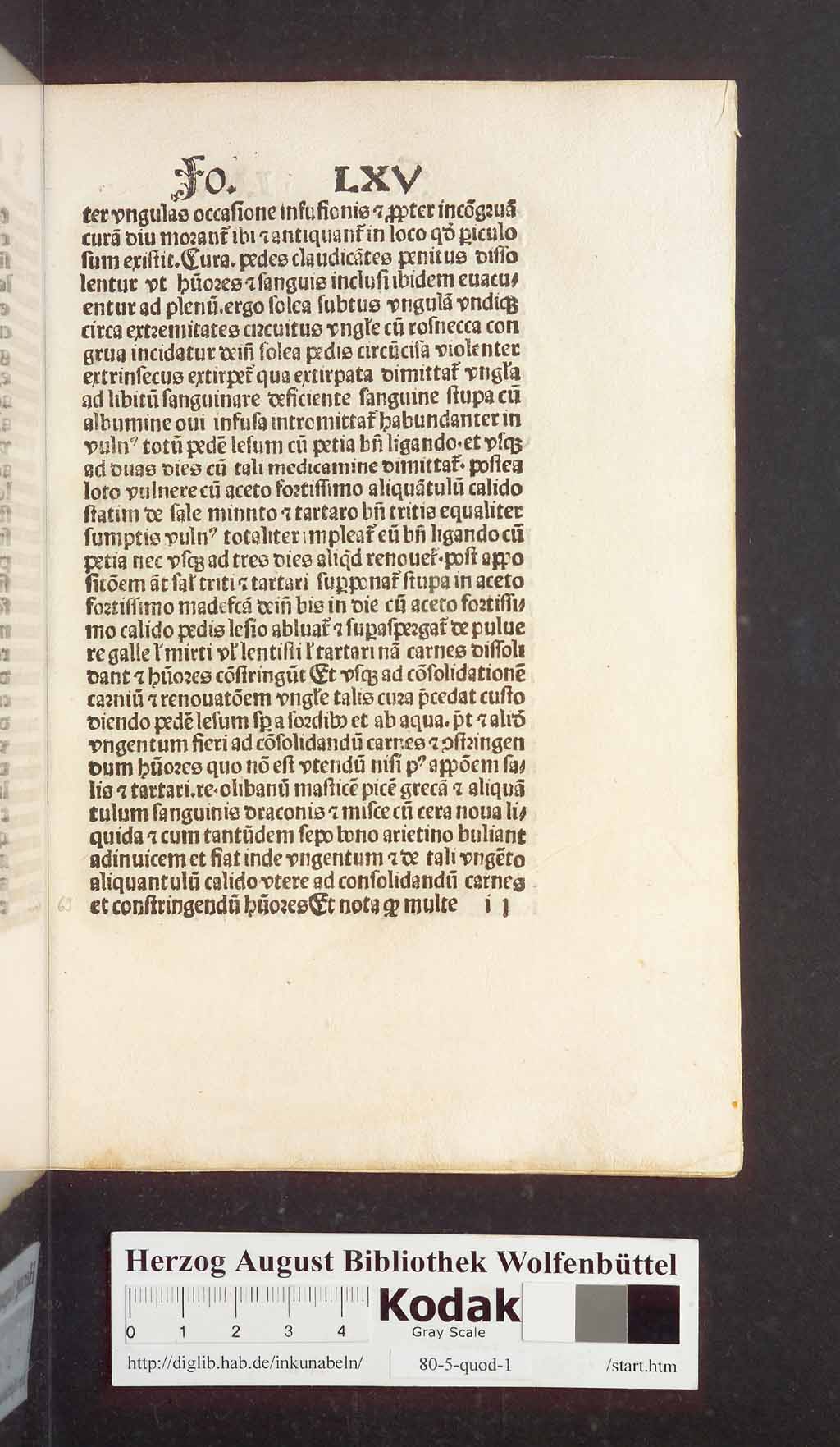 http://diglib.hab.de/inkunabeln/80-5-quod-1/00141.jpg