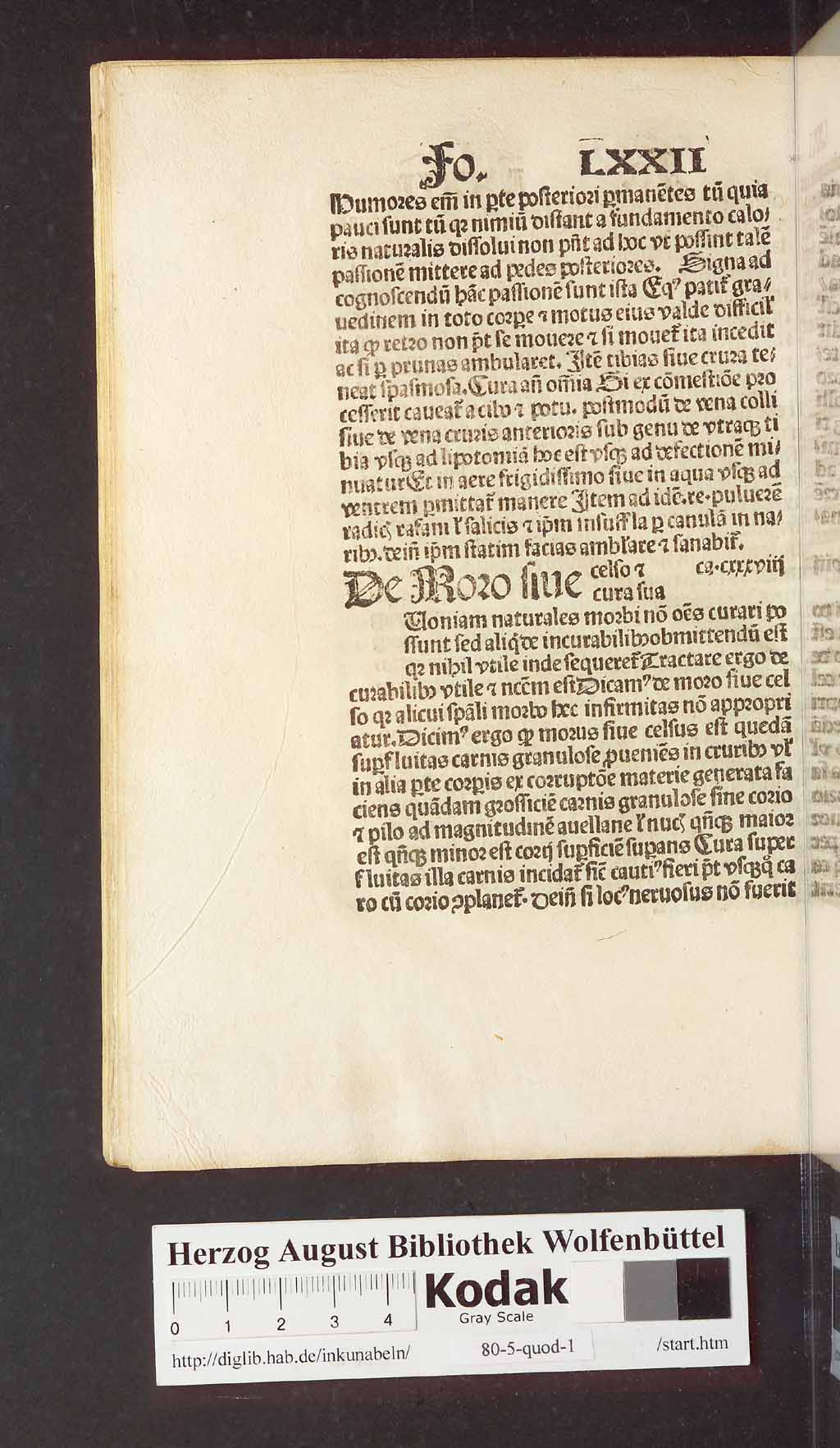 http://diglib.hab.de/inkunabeln/80-5-quod-1/00156.jpg