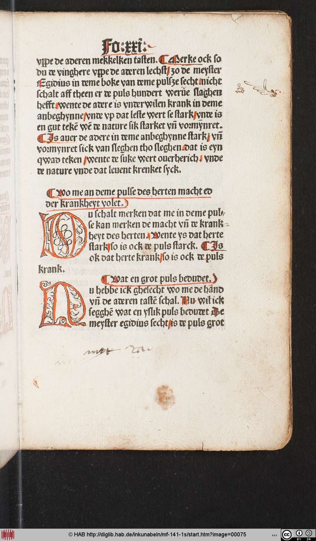 http://diglib.hab.de/inkunabeln/mf-141-1s/00075.jpg